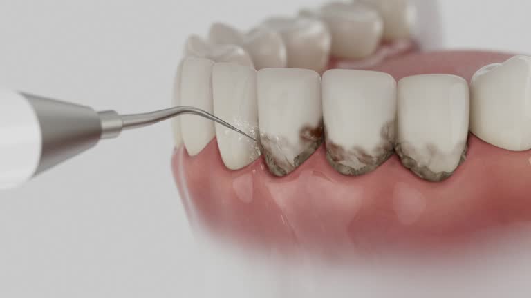 Trusted Teeth Cleaning And Checkup service in Wareham Center, MA - Dentist Open Now